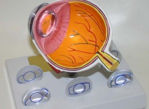 Intra Ocular Lens Model and IOL Lenses