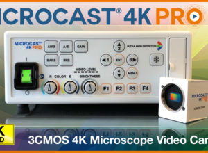 MICROCAST 4K PRO Surgical Microscope Camera – Microscopy Reimagined